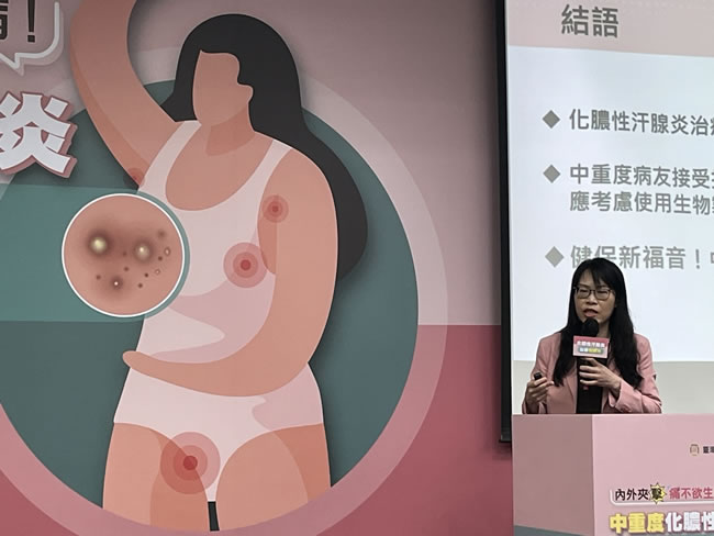 男胯下、屁股「10几处狂爆脓」 错当青春痘 20年才确诊化脓性汗腺炎