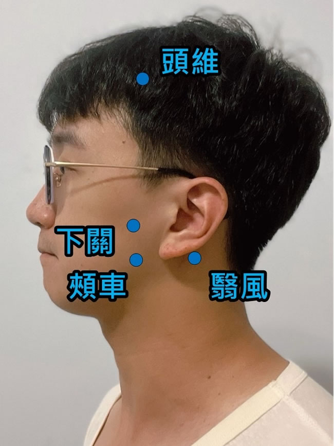 张嘴有喀喀声常耳鸣、肩颈僵硬医药无效？中医针灸治好