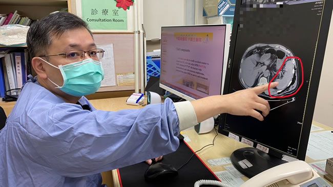 彰化男车祸后2天觉心跳快才就医...一查肋骨断四根、脾脏也破裂